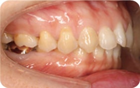 Oral photo with uneven teeth