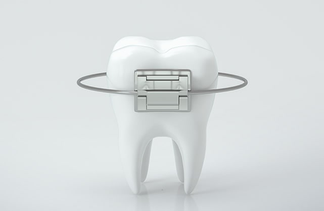 orthodontic treatment illustration image